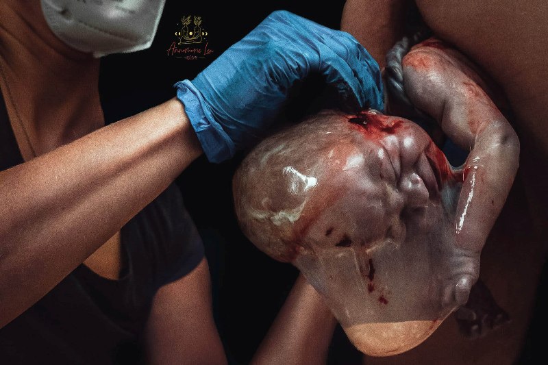 bebê empelicado mãos com luva azul fotos de parto nascimento