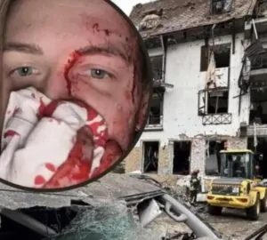 Hotel de jornalistas na Ucrânia destruído em bombardeio, deixando feridos