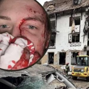 Hotel de jornalistas na Ucrânia destruído em bombardeio, deixando feridos