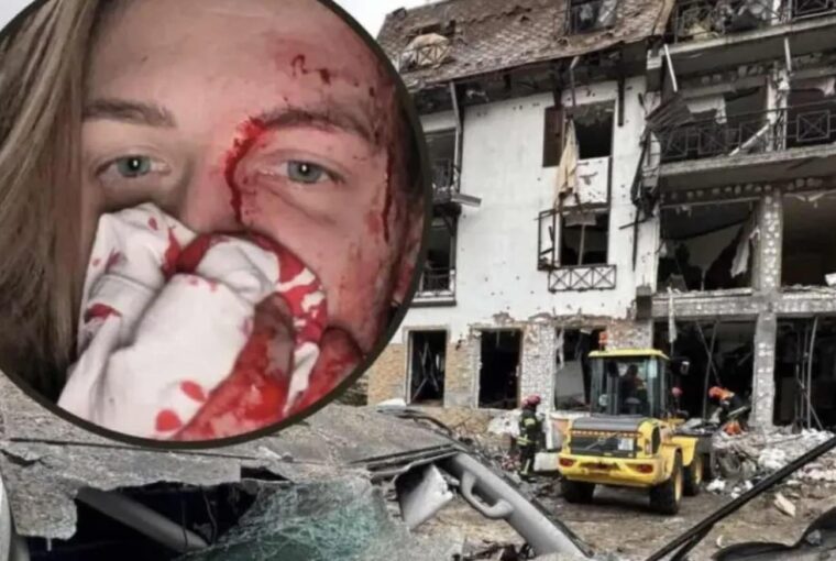 Hotel de jornalistas na Ucrânia destruído em bombardeio, deixando feridos
