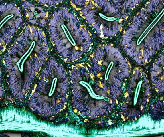 Rede de macrófagos (glóbulos brancos) de um intestino de zebrafish adulto microfotografia fotografia de microscópio