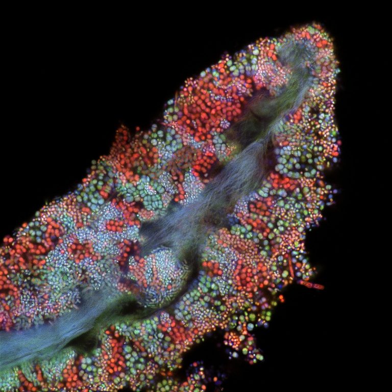 Biofilme bacteriano em uma célula da língua humana microfotografia fotografia de microscópio