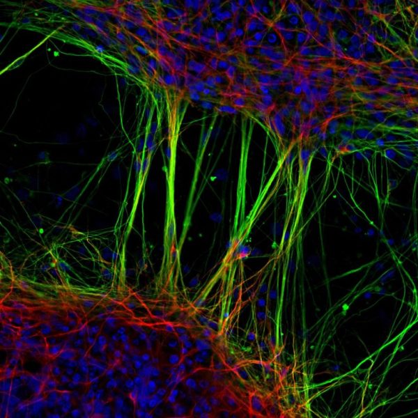 Neurônios humanos derivados de células-tronco neurais microfotografia fotografia de microscópio