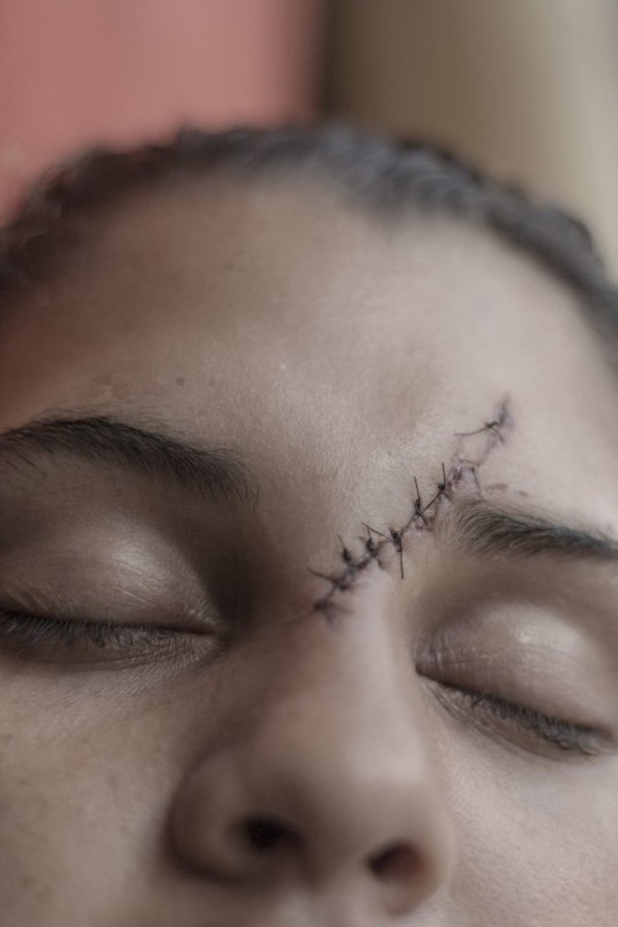 mulher cicatriz Venezuela concurso prêmio fotojornalismo WPP