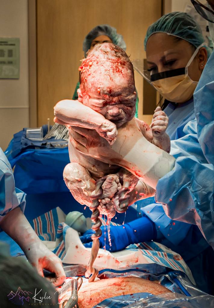 médico segurando bebê fotos de parto nascimento