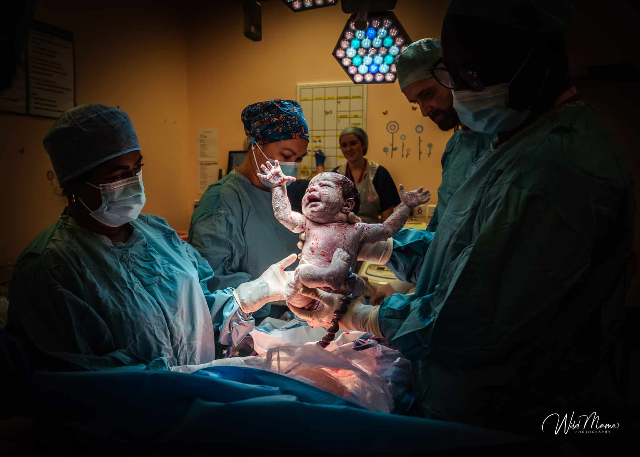 bebê nascendo sala de parto fotos de parto nascimento