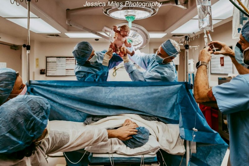 médicos mostram bebê aos pais fotos de parto nasccimento