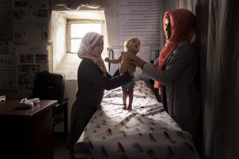  Criança desnutrição exame Foto de guerra conflito Afeganistão fotojornalismo World Press Photo