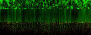 Foto de neurônios motores fica em décimo lugar de concurso de mficrofotografia