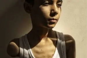 Menino palestino sem braços foto do ano no World Press Photo 2025
