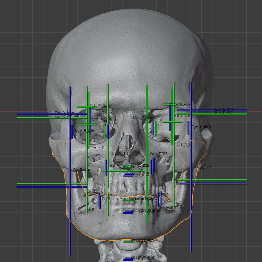 Reconstrução facial São Nicolau, que inspirou Papai Noel 