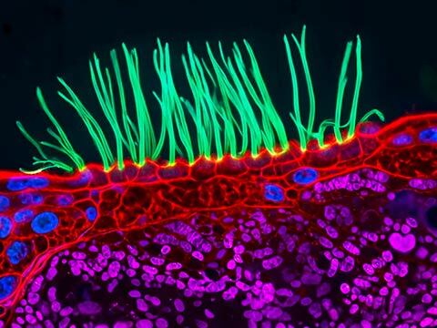 Estruturas ‘alucinadas’ por IA?  Cientistas contestam vídeo de microscopia premiado pela Nikon
